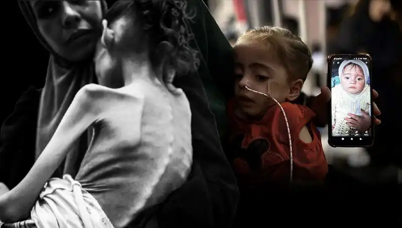 Meryem’in Mücadelesi: 25 Kilodan 10 Kiloya Düşen Küçük Kızın Dramı
